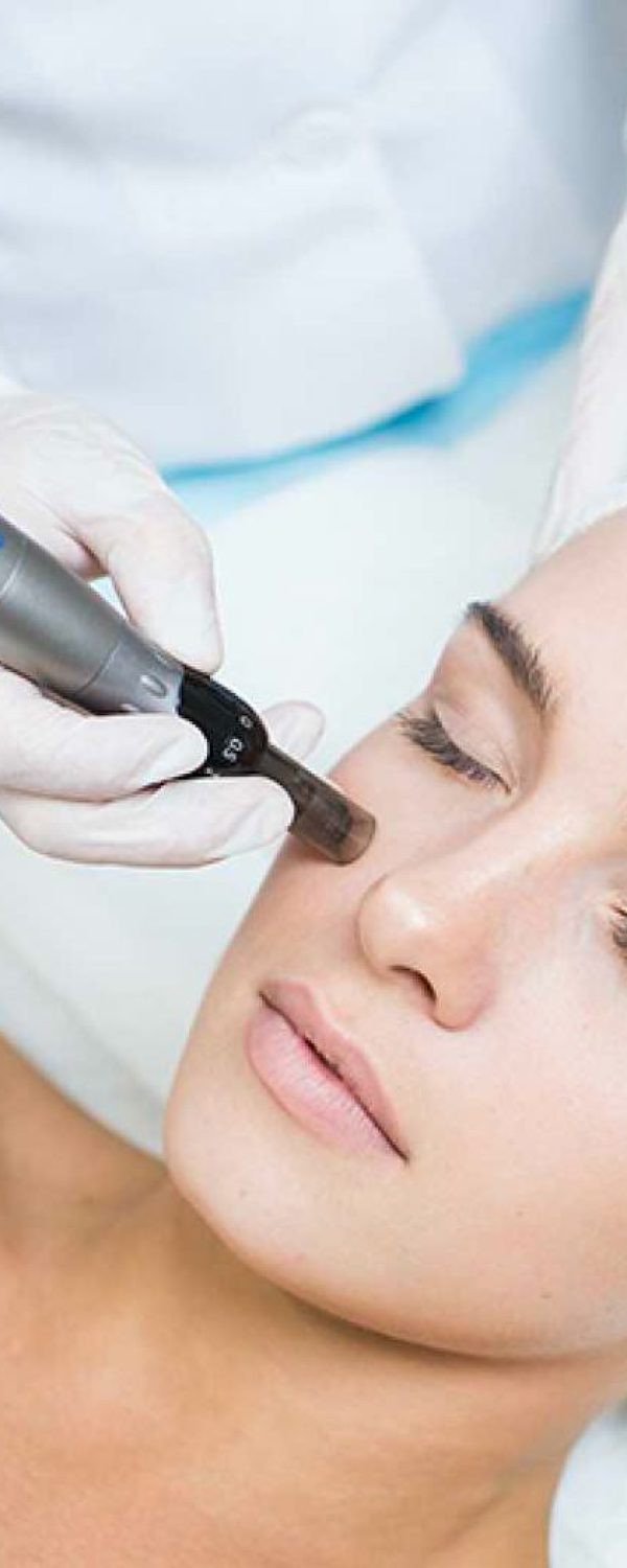 Dermapen_y_Plasma_Rico_en_Plaquetas