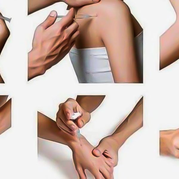 Terapia_Neural